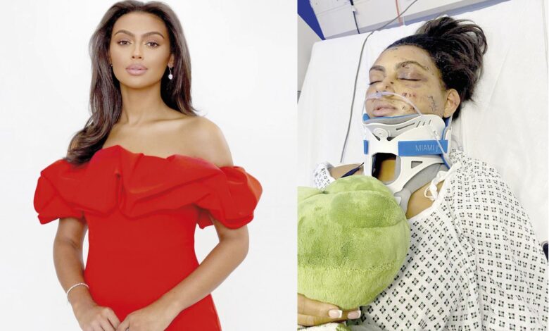 A BEAUTY QUEEN from Barry who was seriously injured in a car accident earlier this year is encouraging people to consider donating blood, platelets and bone marrow this festive season.